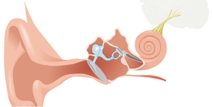 听力损失到什么程度需要选配助听器