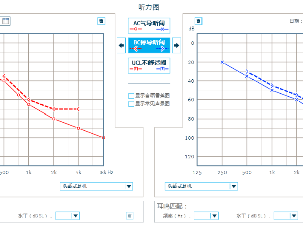 纯音测听有什么用？